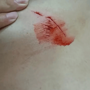 斯德哥尔摩国际vs阿兰达_罕见！大连钓友钓到一条20斤大鲅鱼斯德哥尔摩国际vs阿兰达，反被鲅鱼利齿咬伤胸部